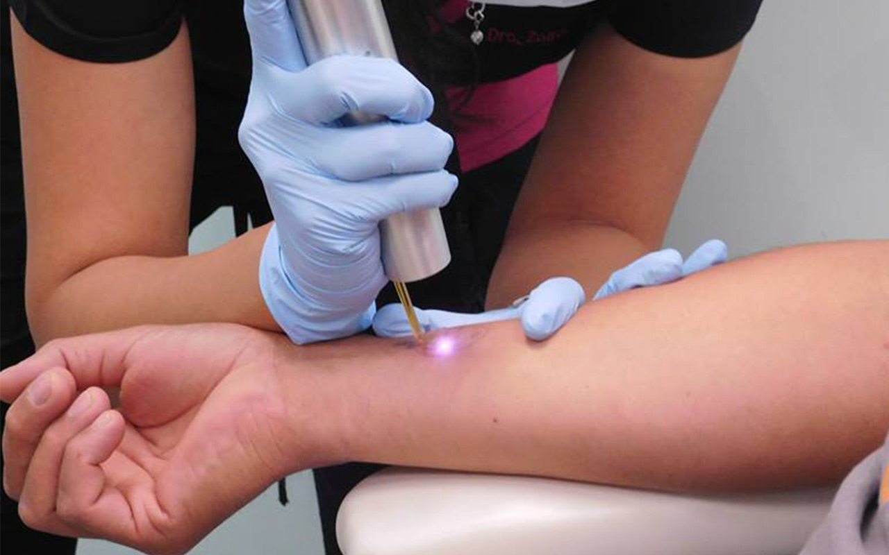 Desarrollan luz led para terapias contra el cáncer de piel