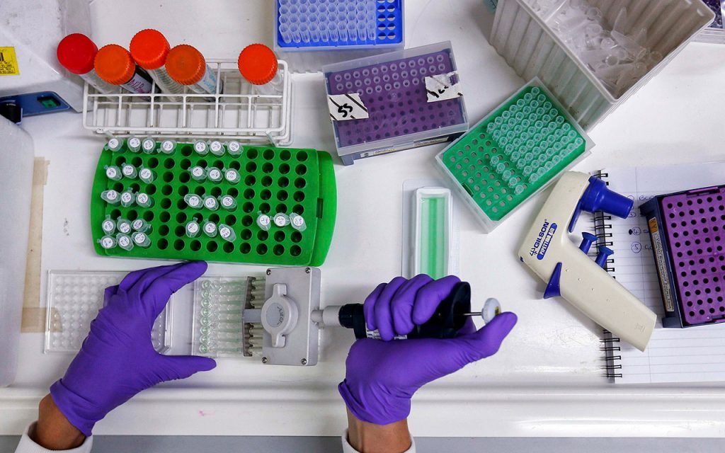 hormona apetito Equipo de la OMS viaja a China para investigar el origen del Coronavirus