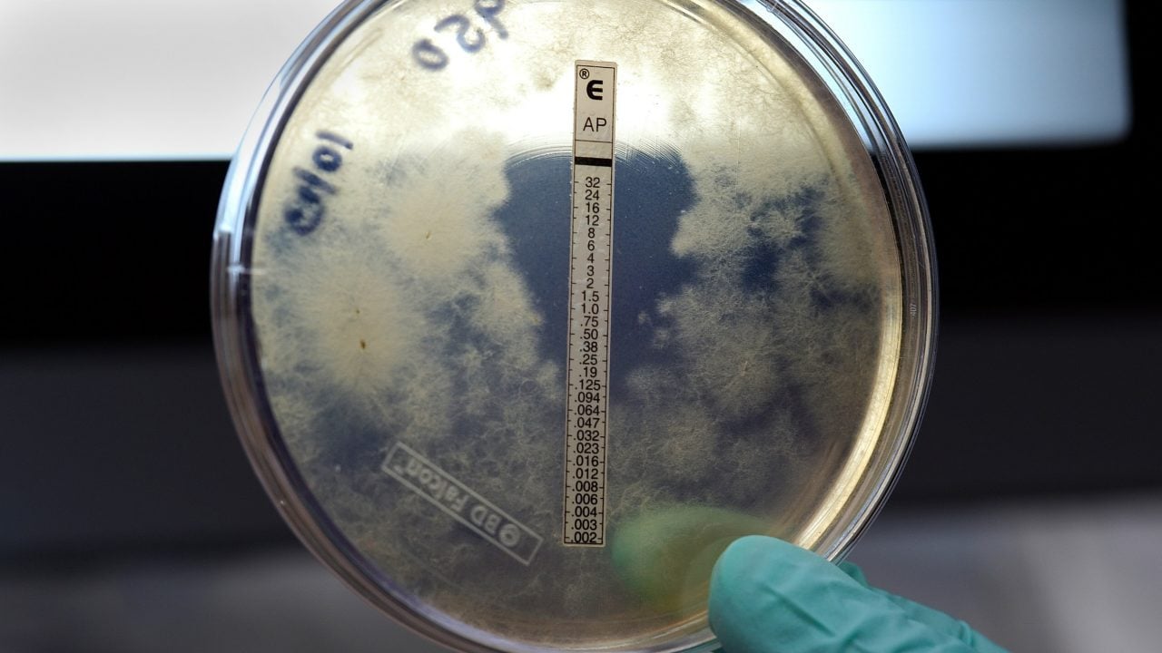 El sarampión es 7 veces más contagioso que el Covid-19, advierten 
