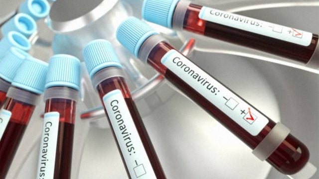 Covid-19 pruebas Moderna Coronavirus