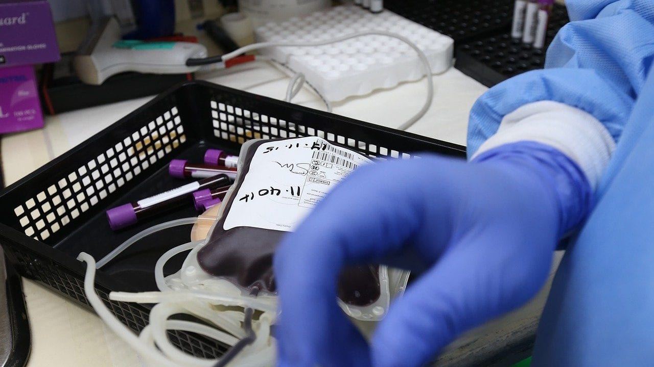 ¿Ayuda el plasma de donantes a tratar casos agudos de COVID-19?