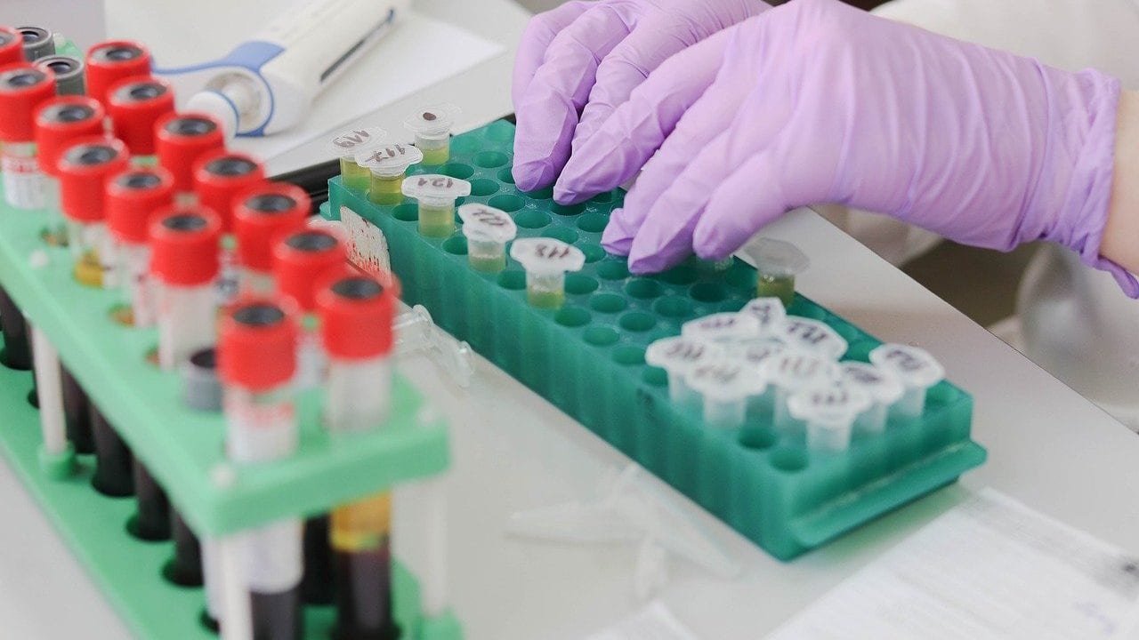 Confidencias: Tesi de México afirma que no participó en licitación del IMSS