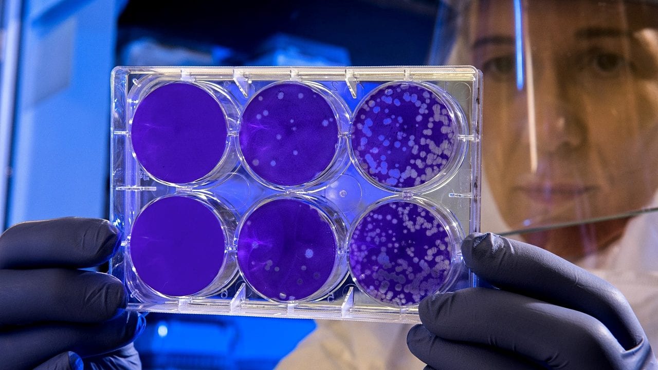 Virus logra infecciones sin activar el sistema inmune; científicos lo estudian