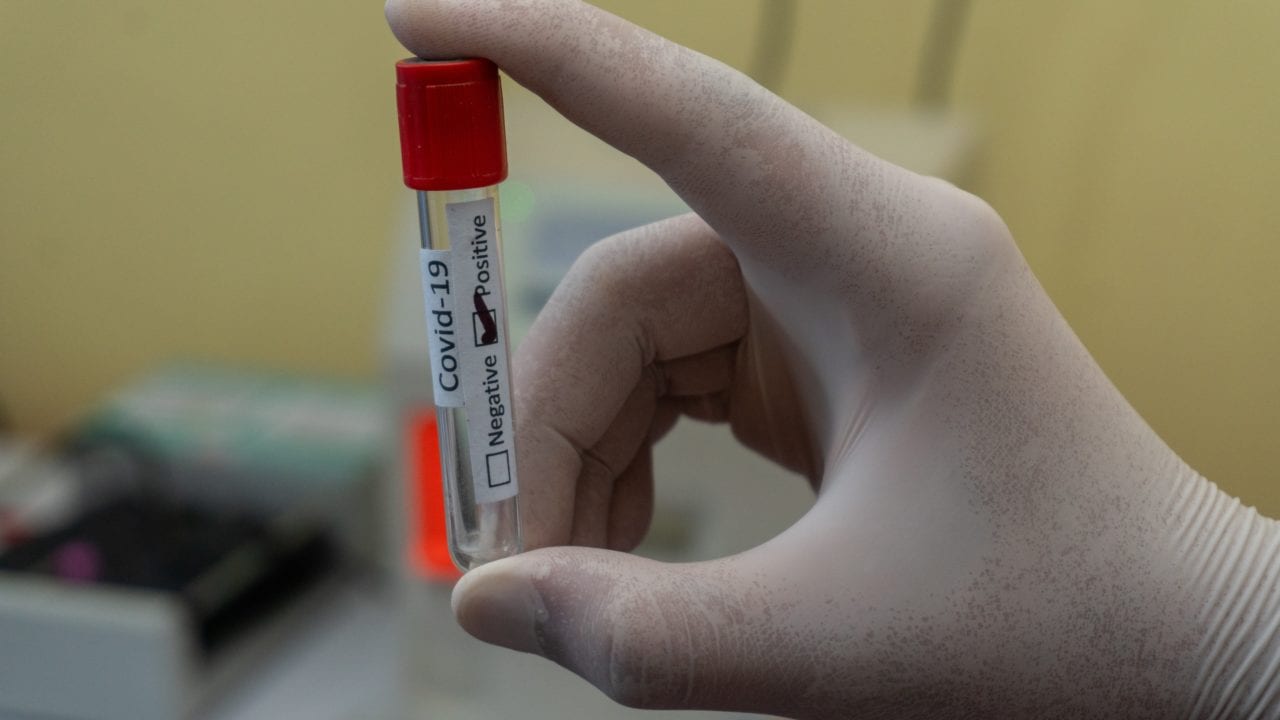 Aprueban primer estudio anticovid en el cual se infecta a gente