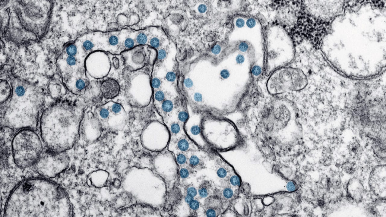 Científicos hallan ‘punto débil’ del coronavirus