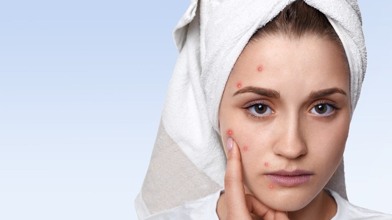My NextDerma buscará crecer 50% mes a mes este 2021