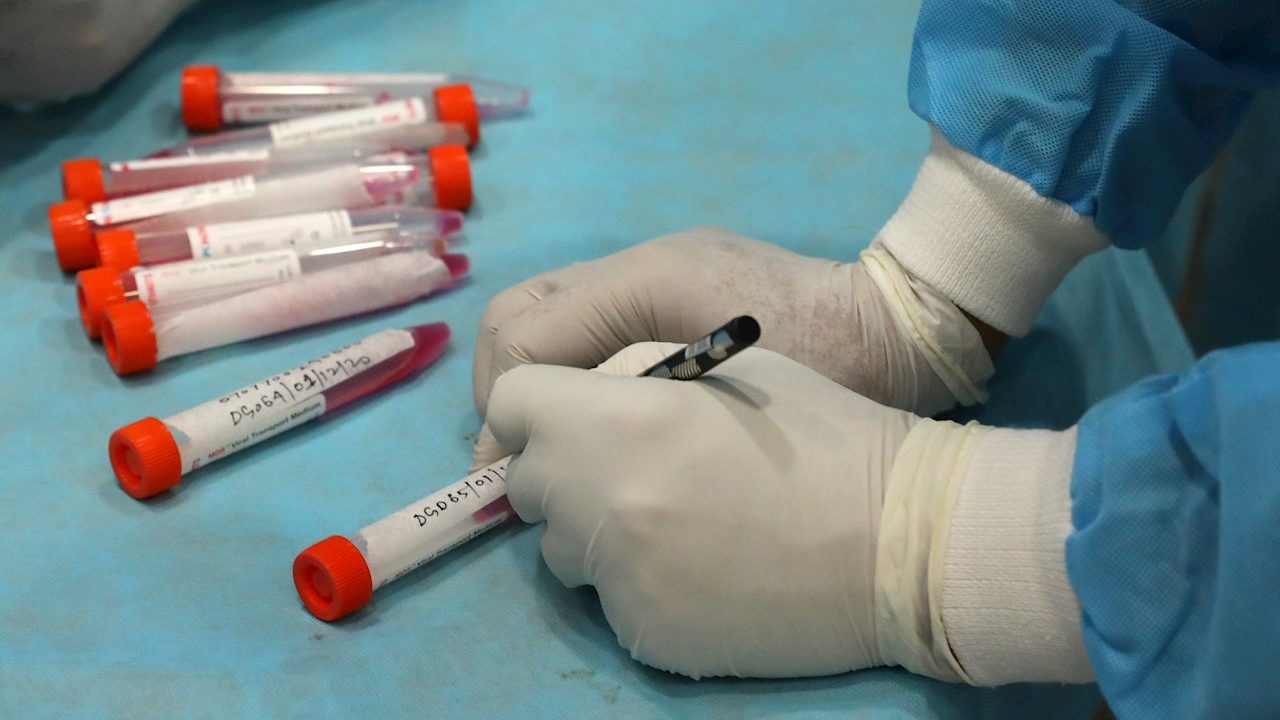 Cierran laboratorio en Reino Unido tras 43,000 test Covid-19 erróneos