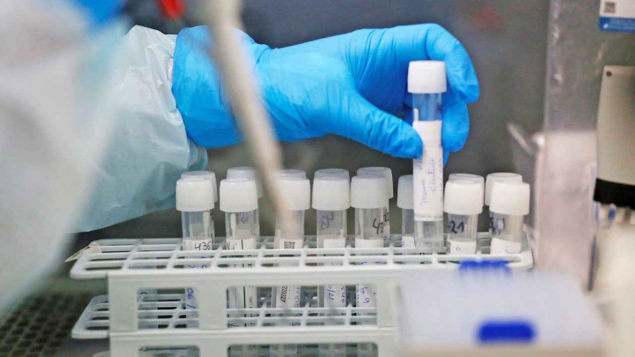 Desarrollan en EU  hidrocarburos a partir de azúcares de la bacteria E.coli