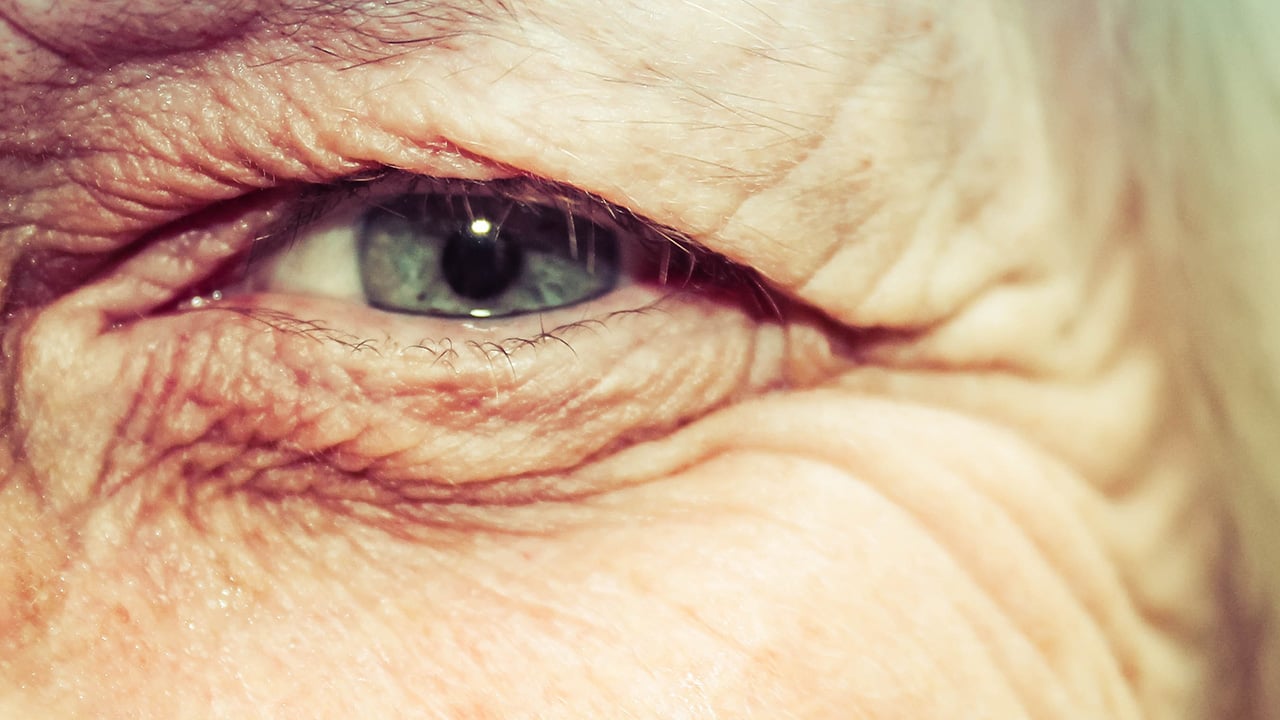 Anciana recibe primer implante de chip biónico en el ojo en Reino Unido