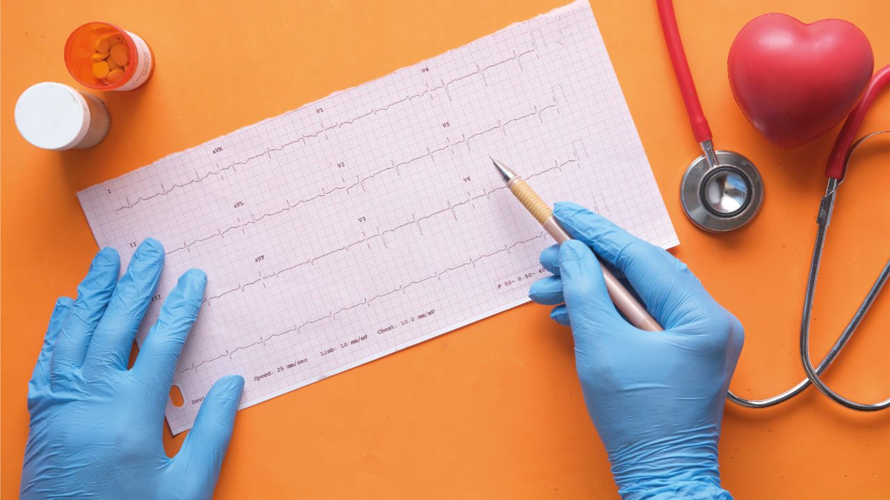 Cardiólogos anuncian nuevo método para predecir una muerte súbita