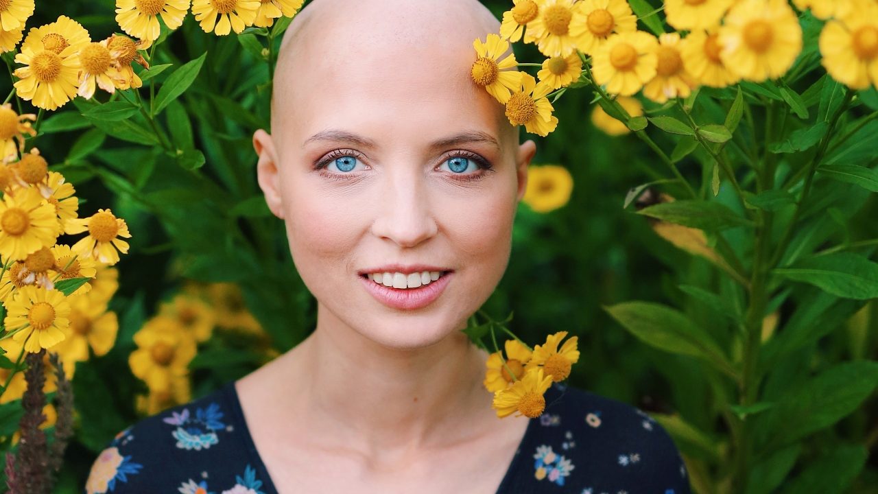 ¿Qué es la alopecia y cuáles son sus principales síntomas?