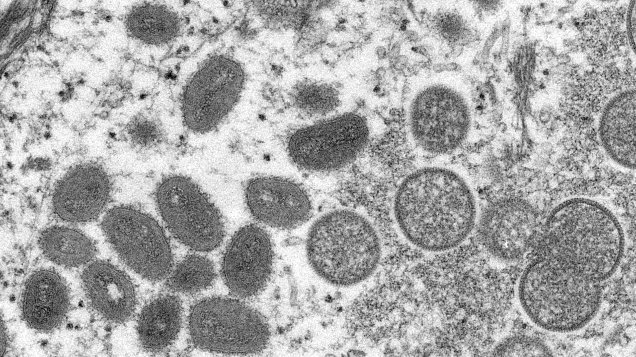 Número de casos de viruela del mono en Reino Unido se duplica y llega a 20