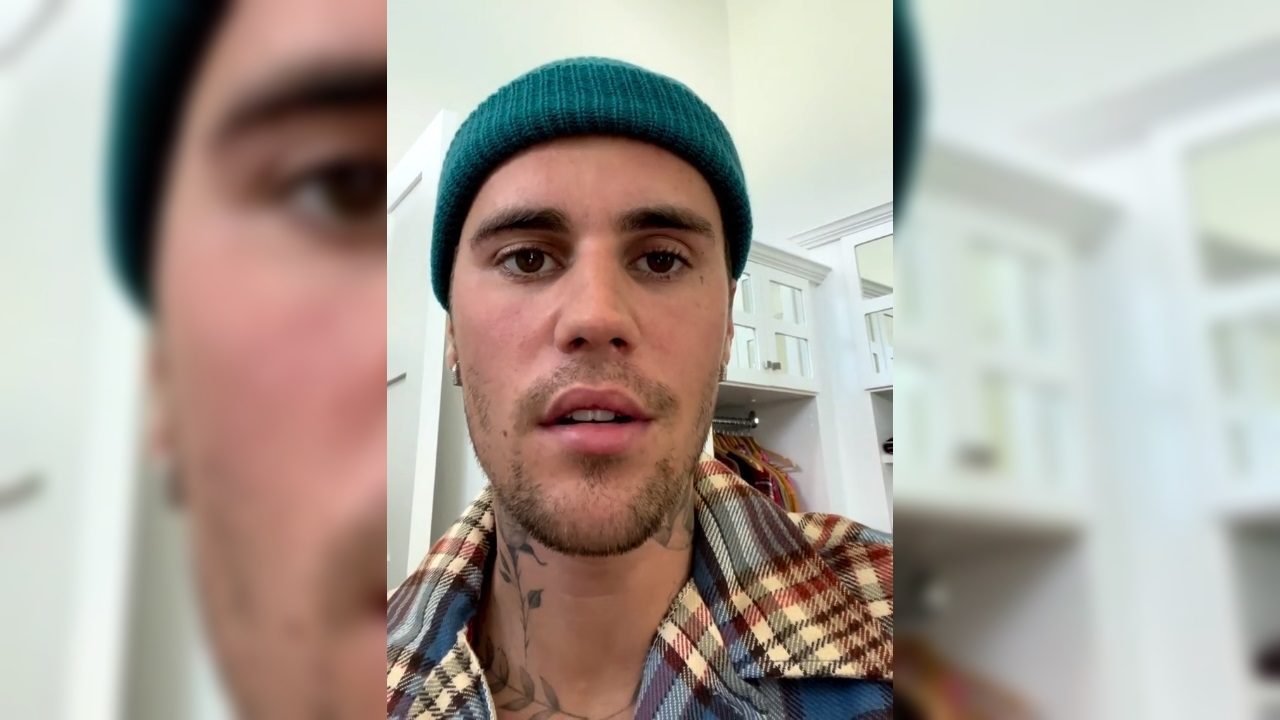 Justin Bieber pospone conciertos por padecer parálisis facial parcial por un virus
