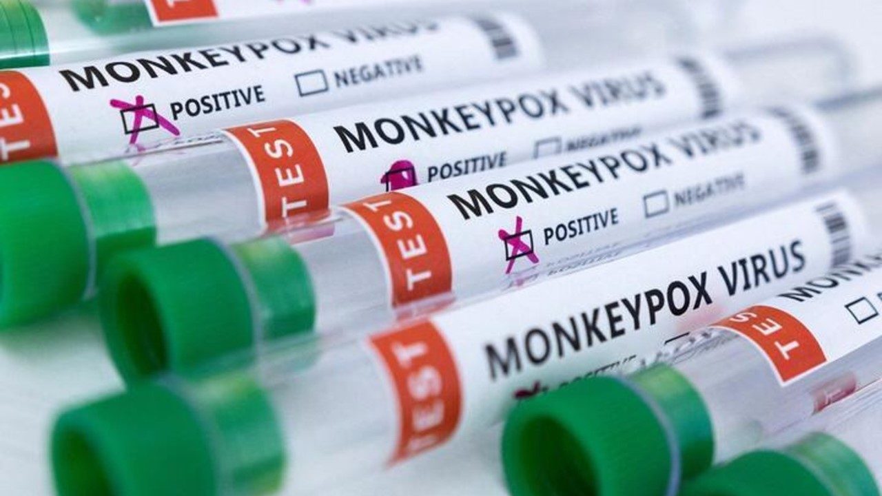 México supera los mil casos confirmados de viruela del mono