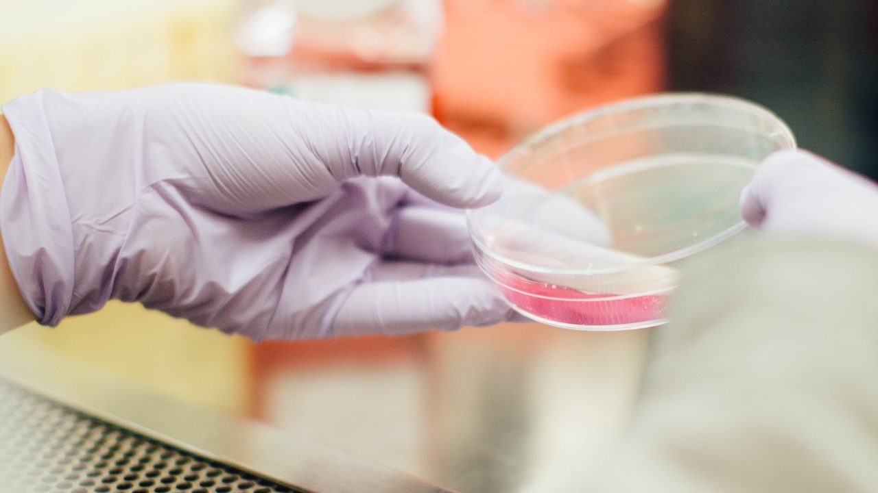 Lo que debes saber sobre el potencialmente peligroso virus Oropouche detectado en EU: Fiebre de la pereza