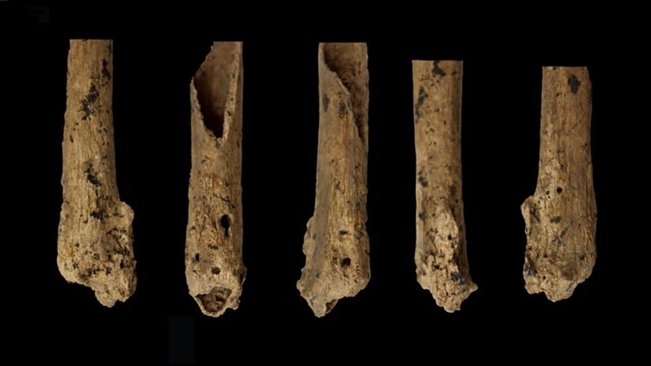 La primera amputación quirúrgica se habría realizado hace 31,000 años