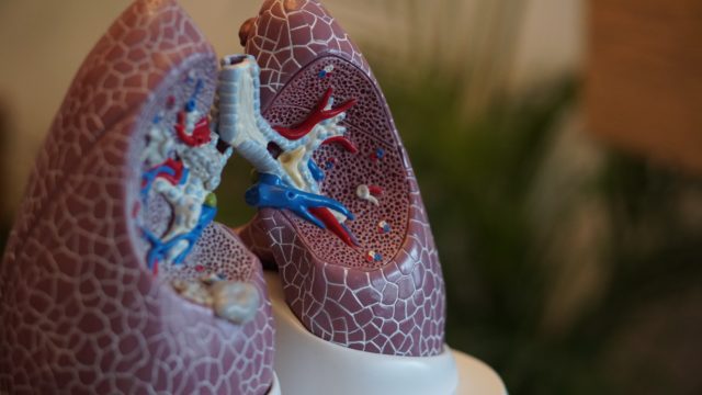 Proteína cáncer pulmón fármacos