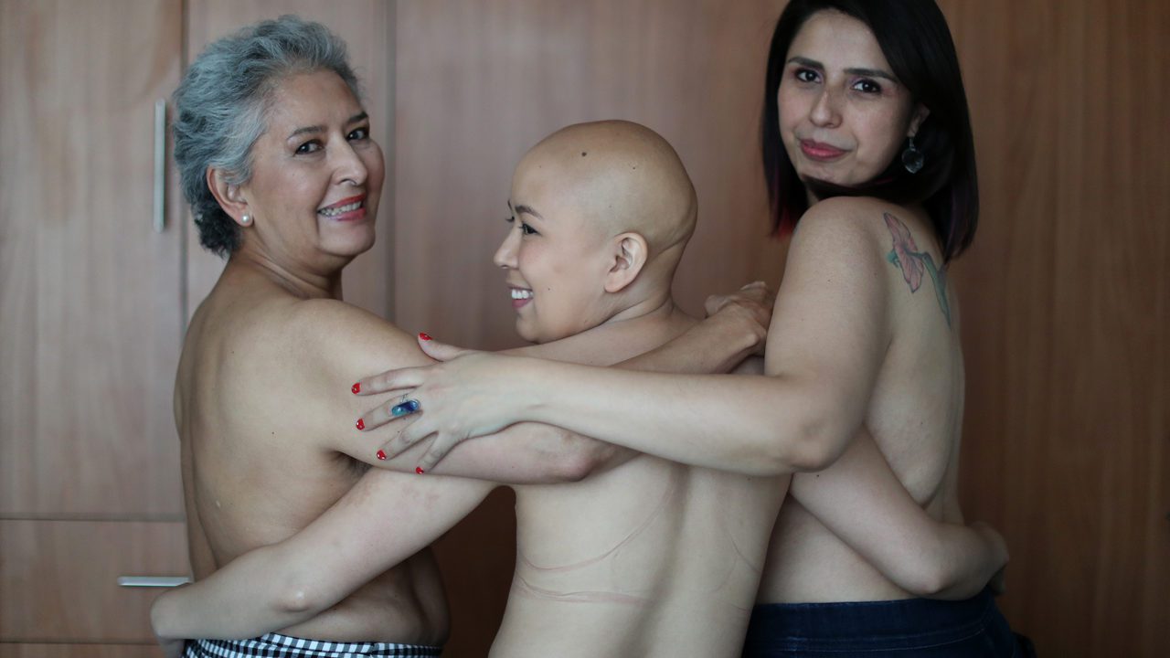 Índice busca reducir tiempo de diagnóstico sobre cáncer de mama en México