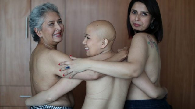cáncer de mama tres generaciones