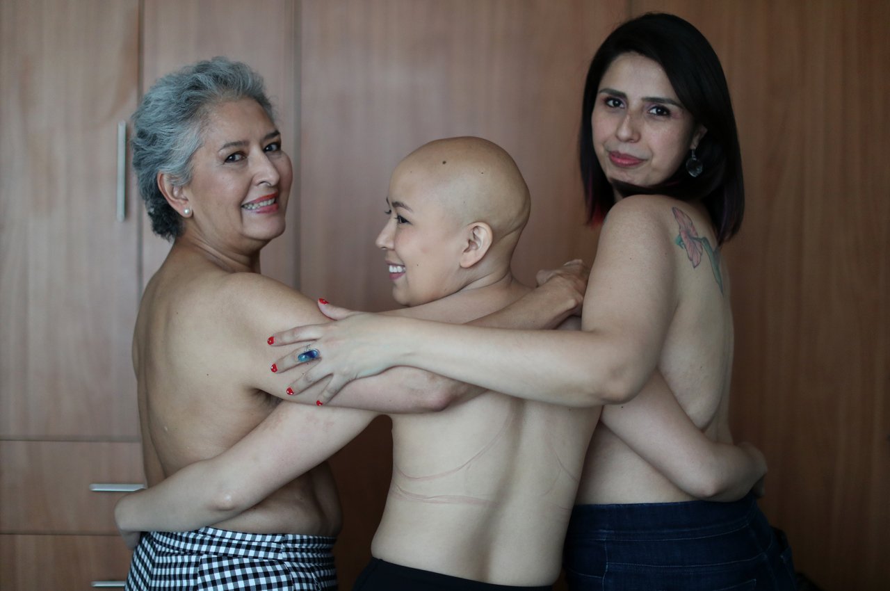 cáncer de mama tres generaciones