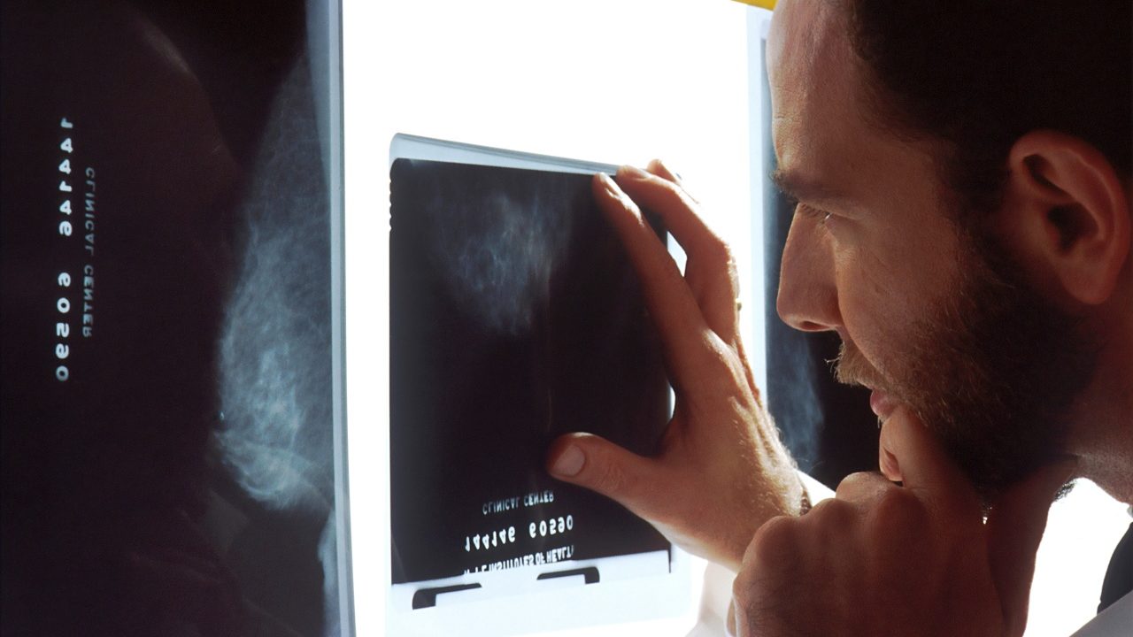 Científicos desvelan los factores que impulsan el osteosarcoma, un cáncer óseo agresivo