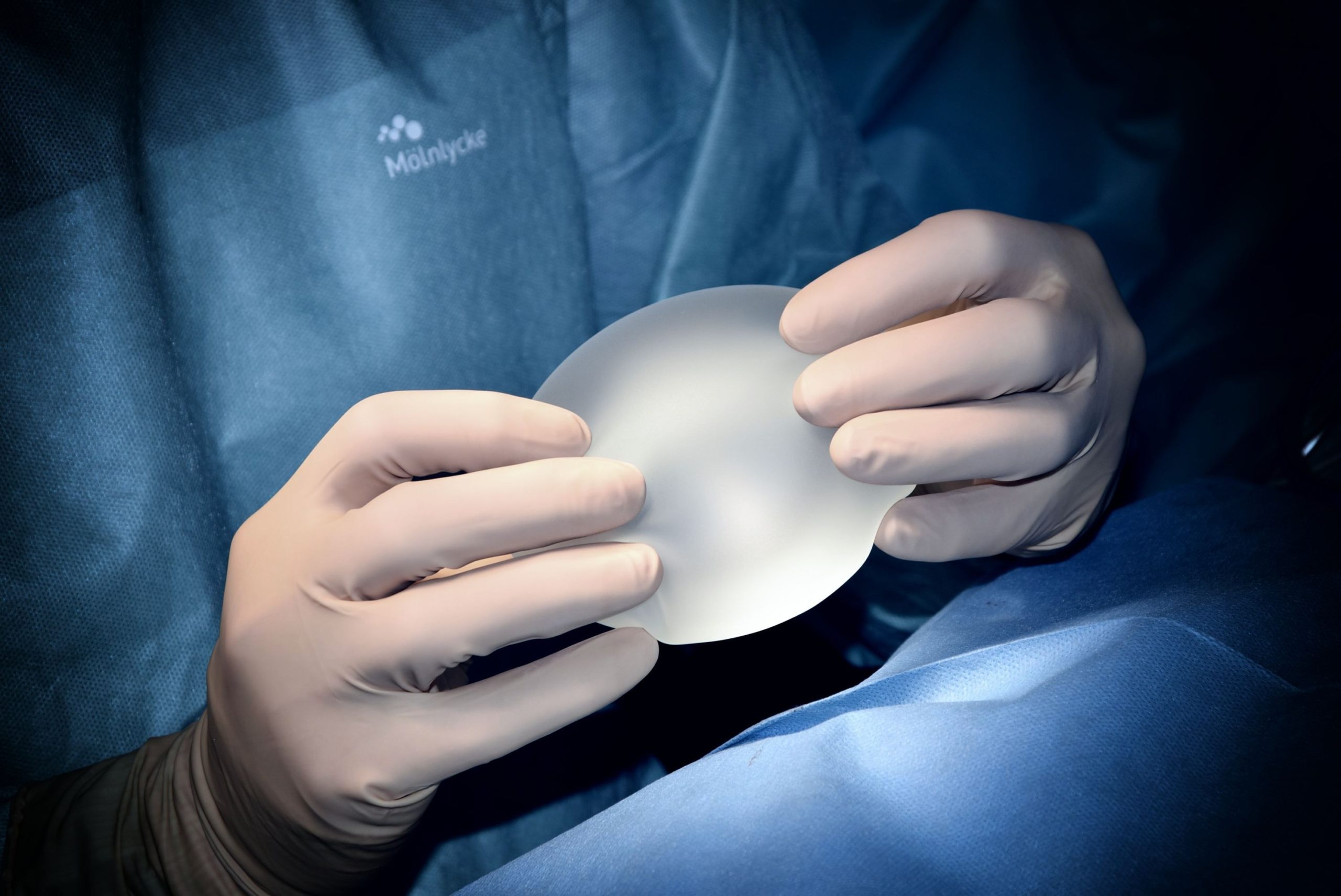 Alertan sobre síndrome de ASIA: afecta a implantes mamarios