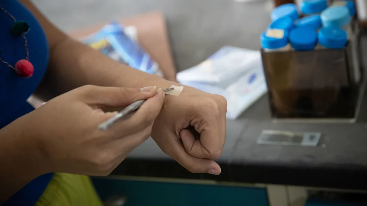 Convertir cáscara de camarón en cicatrizante, la idea de una joven venezolana