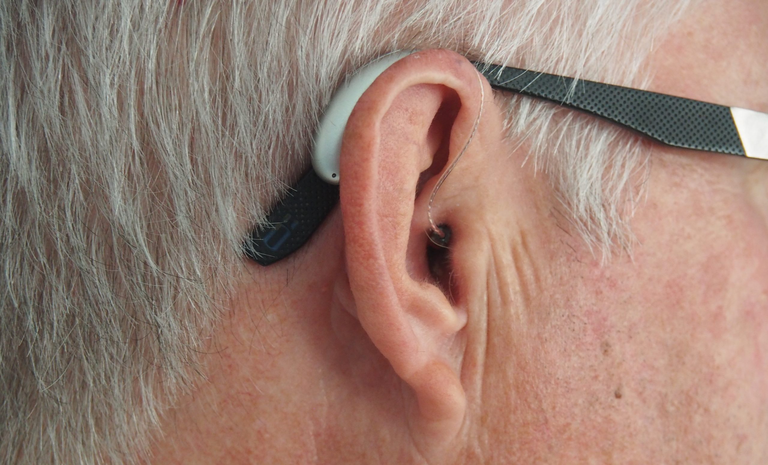 Estudio asocia la pérdida de audición a un mayor riesgo de demencia