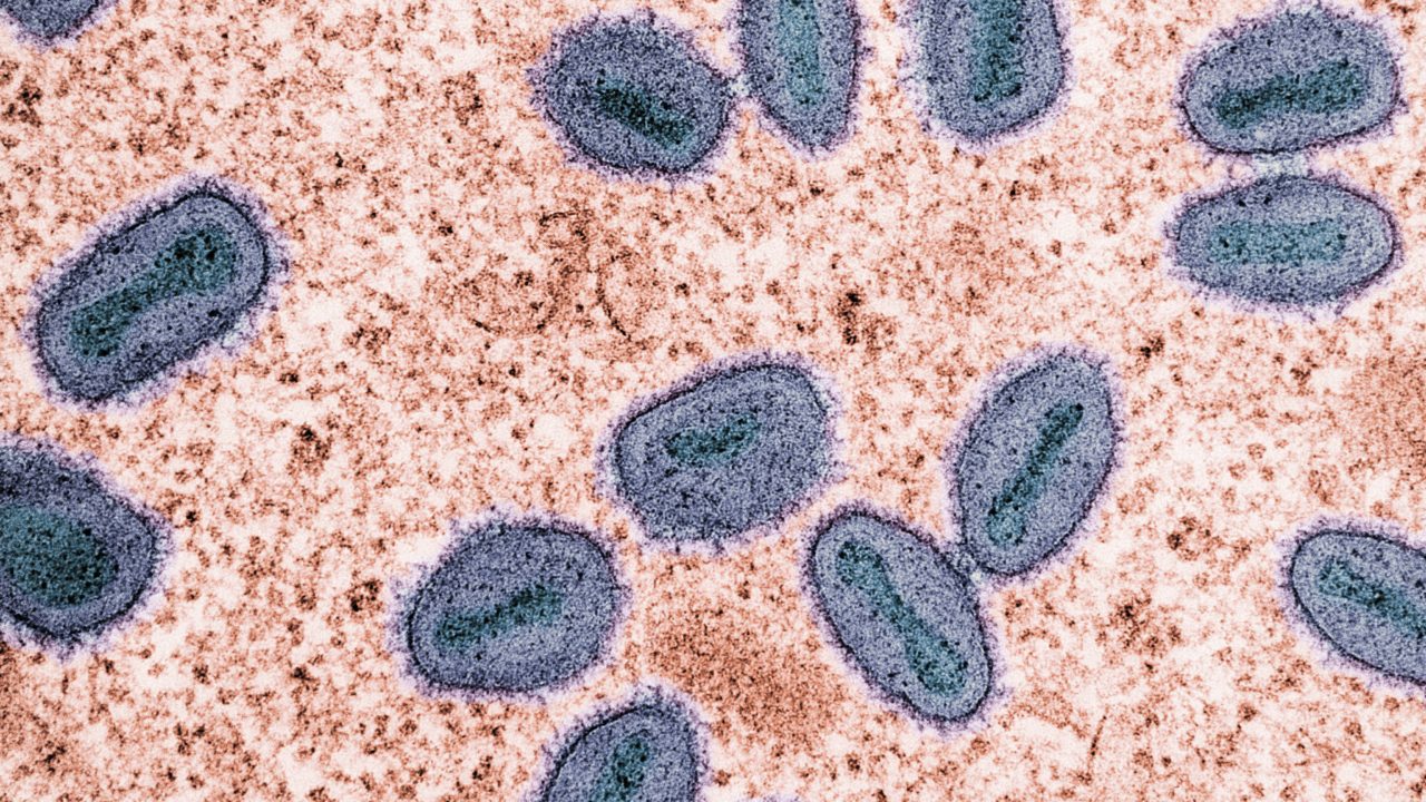 Microbios responsables de la descomposición humana podrían ayudar en la labor forense