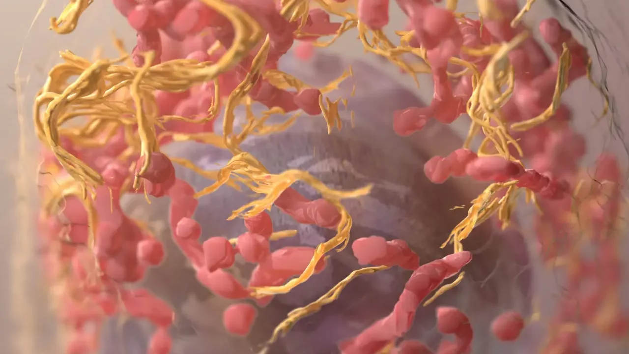 Un proyecto pionero estudia la eficacia de la inmunoterapia en el melanoma infantil
