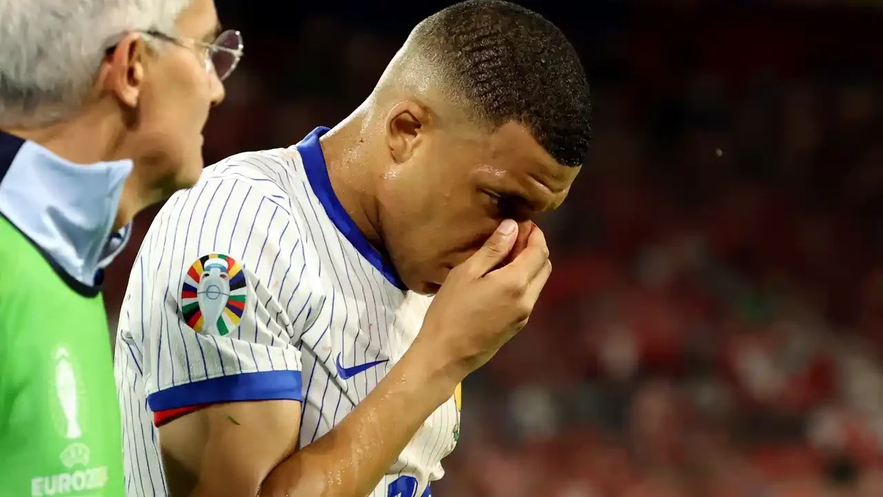 Mbappé se fractura la nariz, regresa a la concentración y jugará con máscara