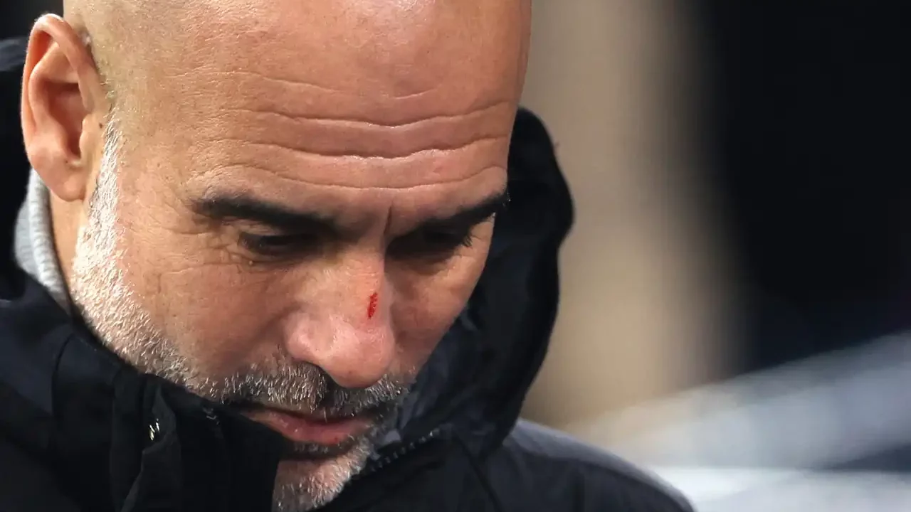 Guardiola aclara sobre sus heridas: ‘No quería quitar importancia a las autolesiones’