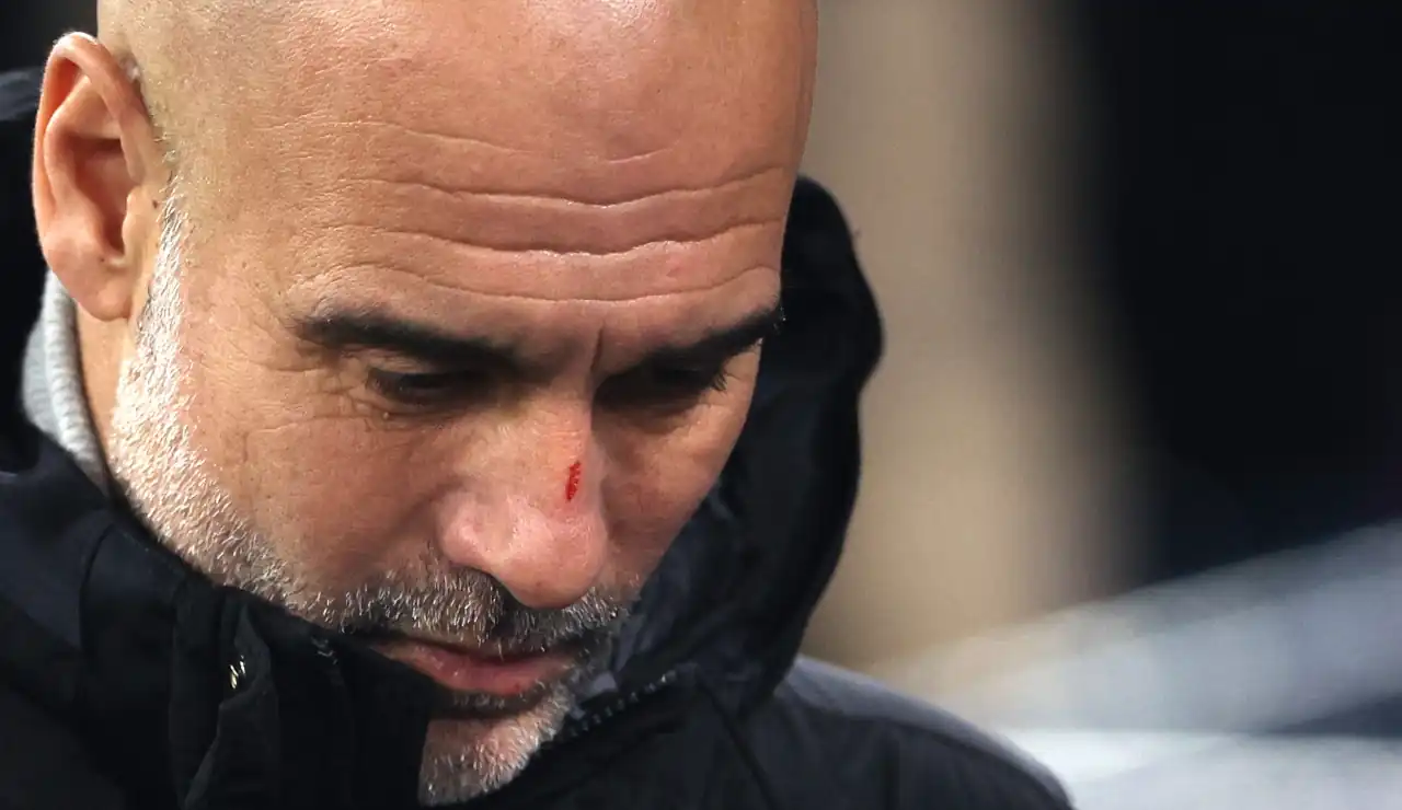 Guardiola aclara sobre sus heridas: ‘No quería quitar importancia a las autolesiones’