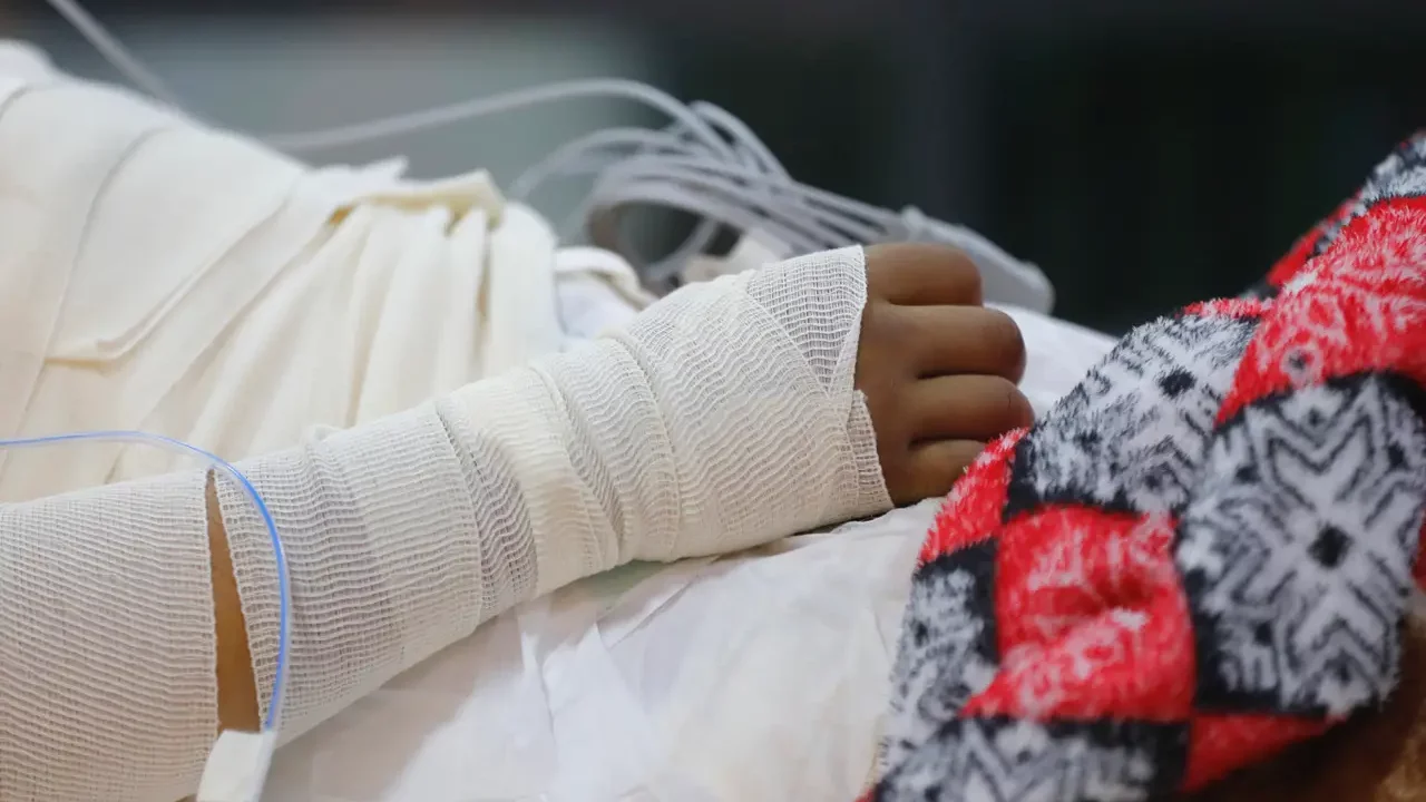 Expertos alertan de quemaduras en adolescentes en México por bromas o pugnas del crimen organizado