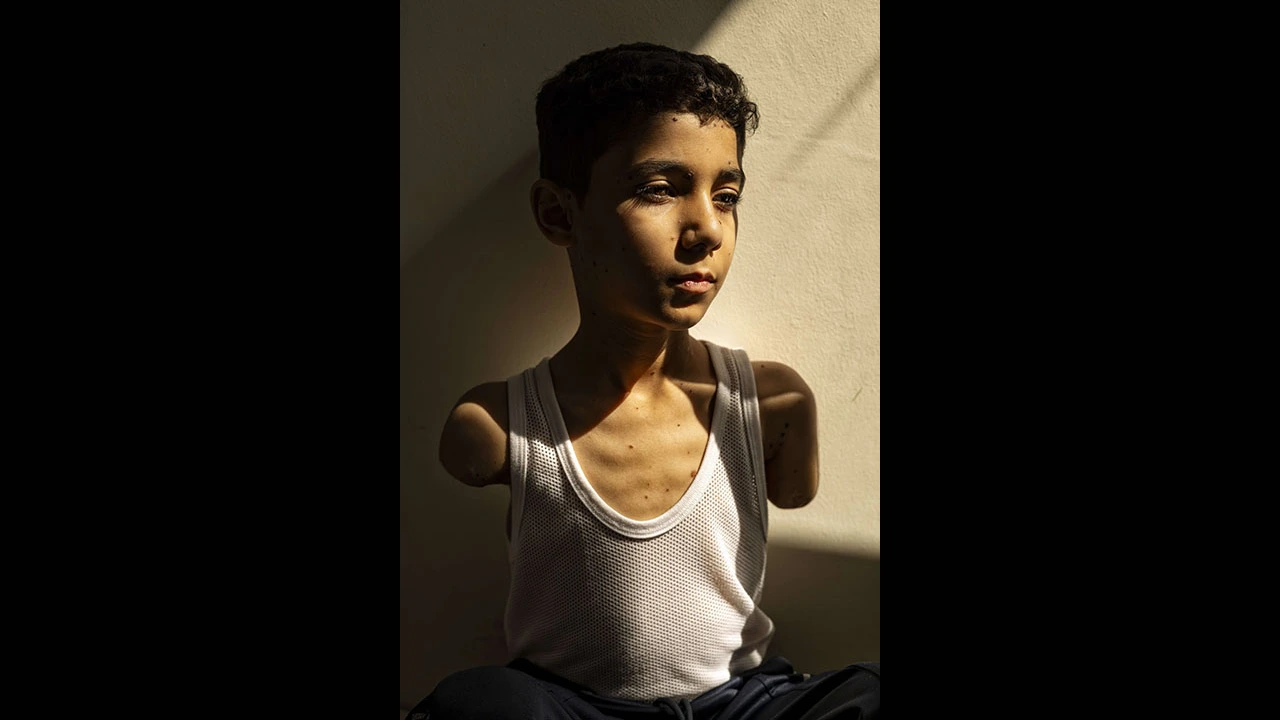 Una foto sobre un niño de Gaza que perdió los gana el World Press Photo global