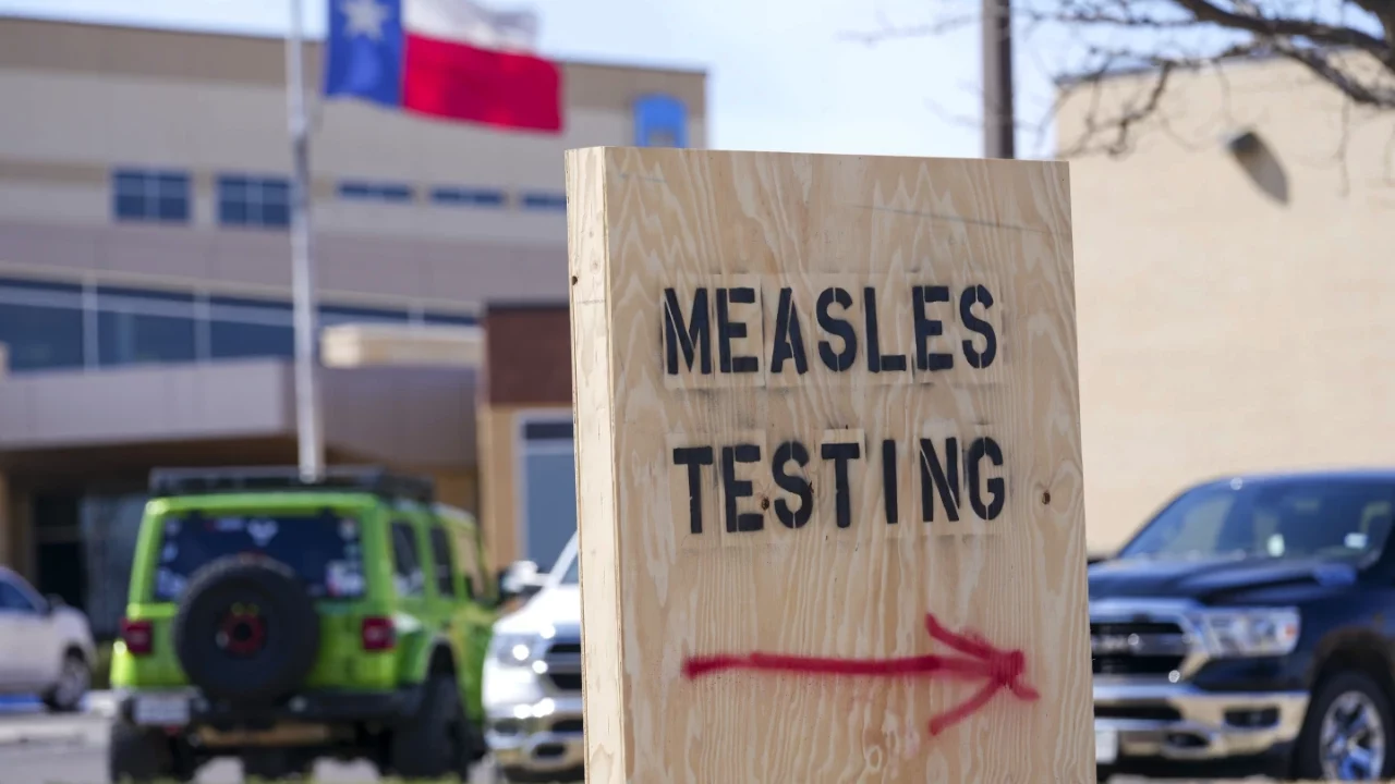 Casos de sarampión en Texas aumentan a 683 señala el departamento de salud estatal