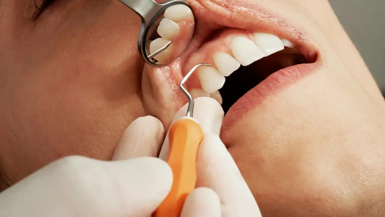 Cómo una boca llena de caries dio pie a una startup y a importantes lecciones sobre dinero